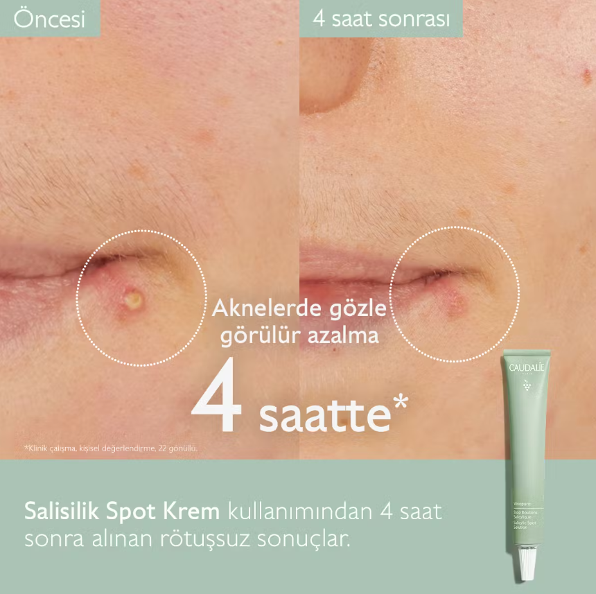 Caudalie Vinopure Stop Boutons Salicylique 15 Ml - 4