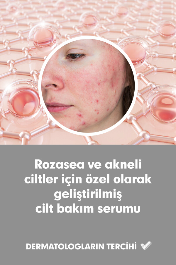 Tto Clinic Roze Cilt Bakım Serumu 50 Ml - 3